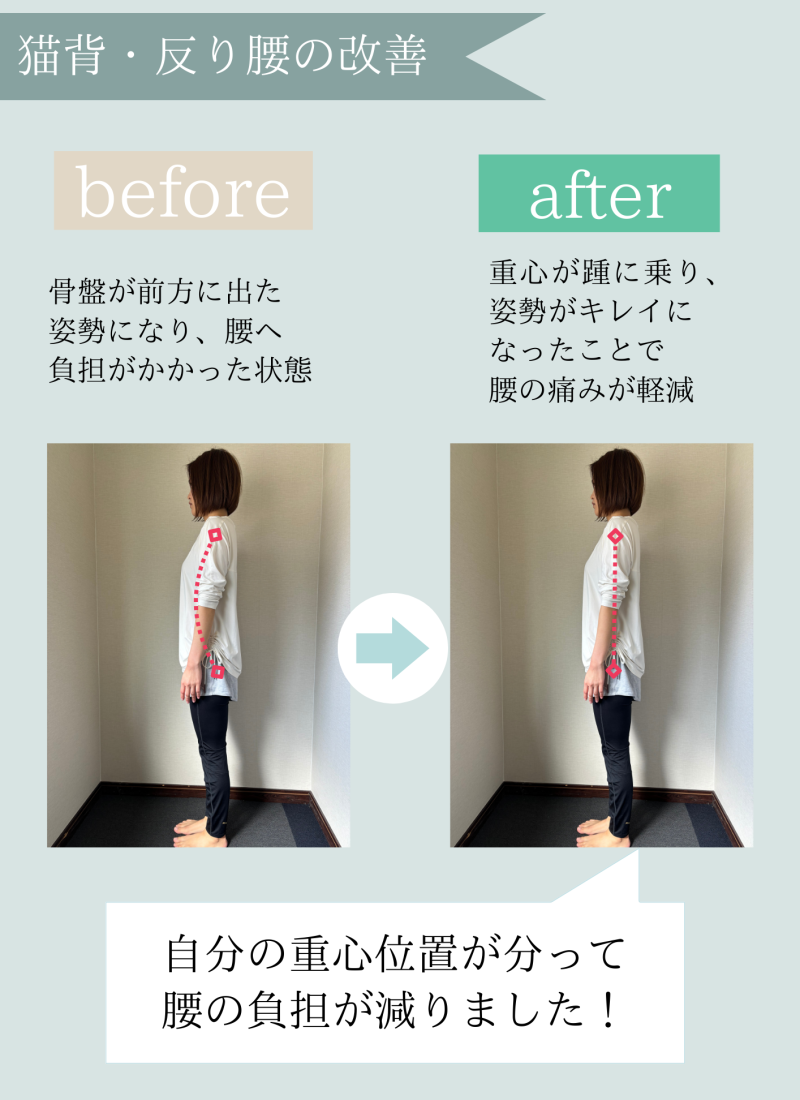 猫背反り腰の改善