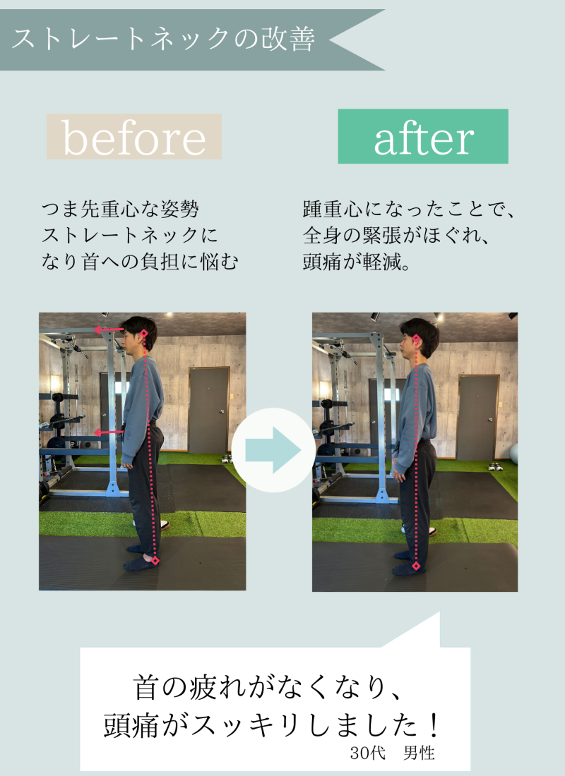 ストレートネックの改善